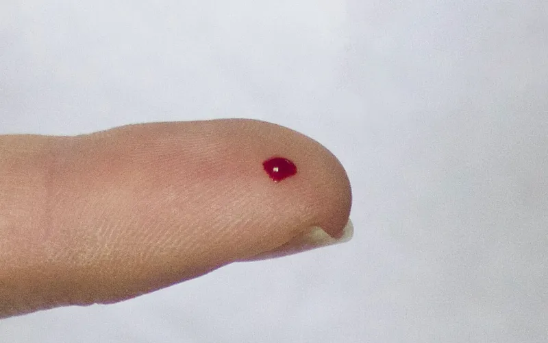 Bloddroppe på finger