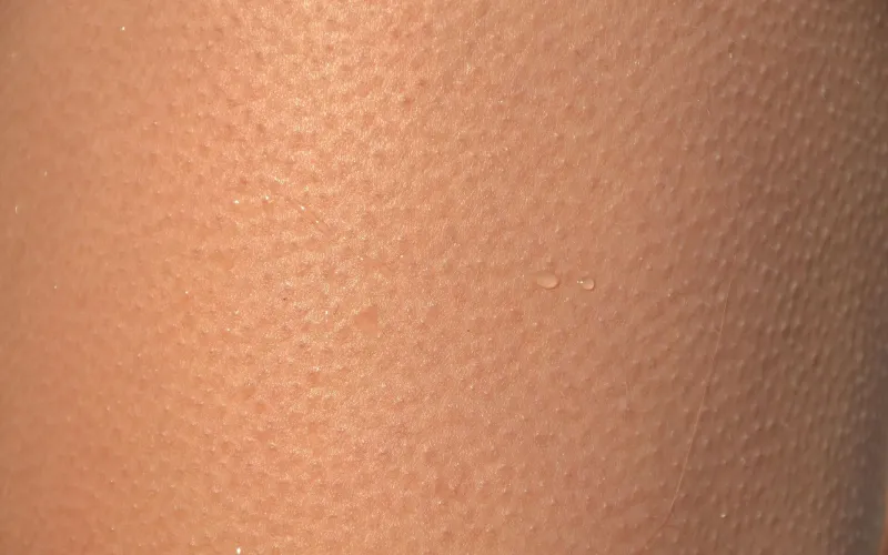 Hud på en människa