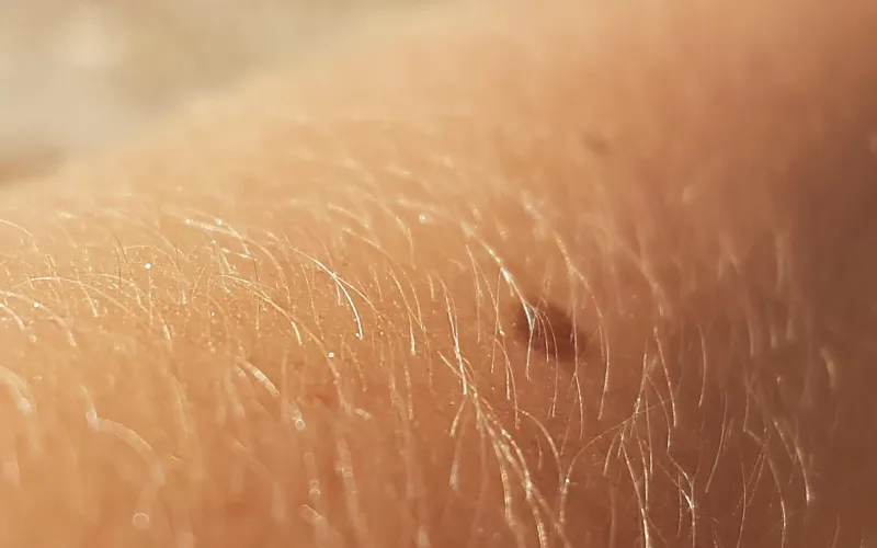 Närbild på en arm och dess behåring